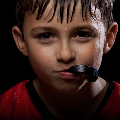 blog-featured-image-mouthguards-for-braces