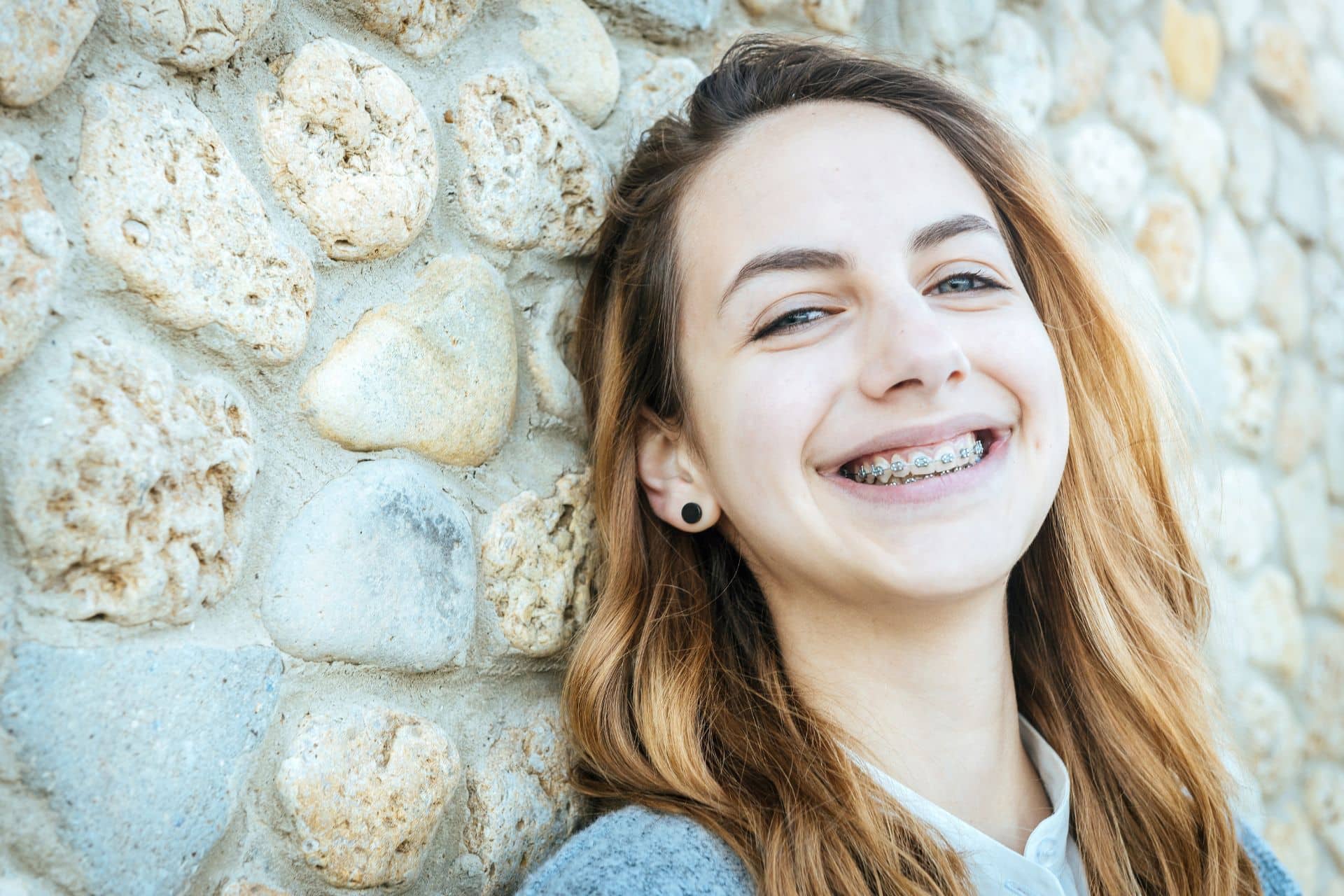 Retainers After Braces: Your Helpful Guide Flanagan Orthodontics in Rockford and Winnebago, IL